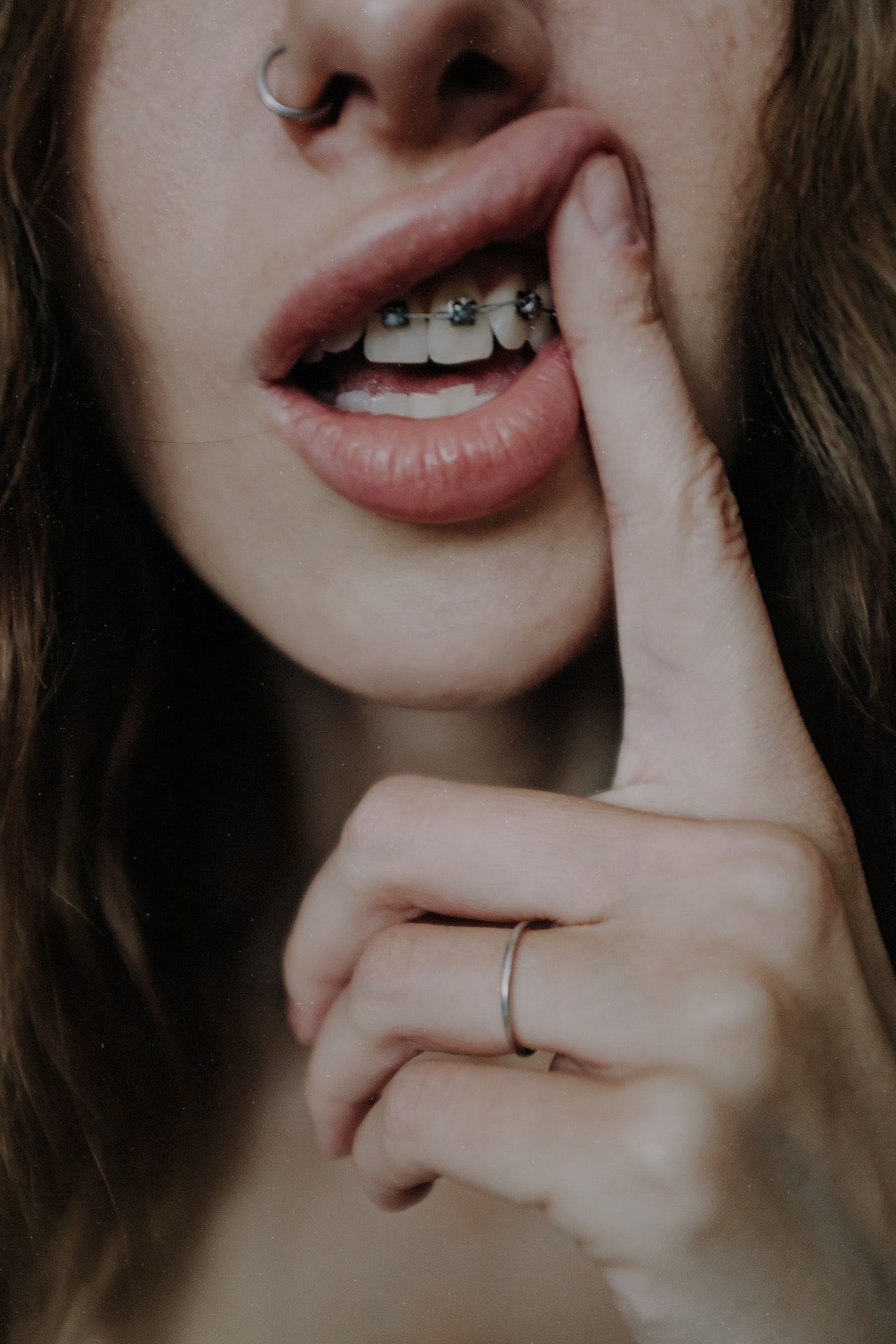 3 Problems You Should See Your Orthodontist About